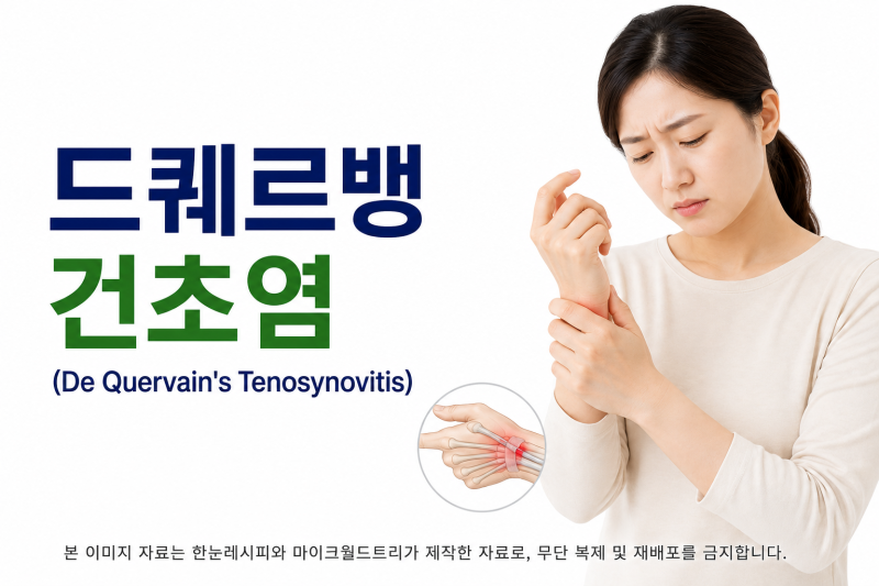 손목 엄지 쪽이 시큰하고 힘이안 들어간다면 — 드퀘르뱅건초염일 수 있습니다