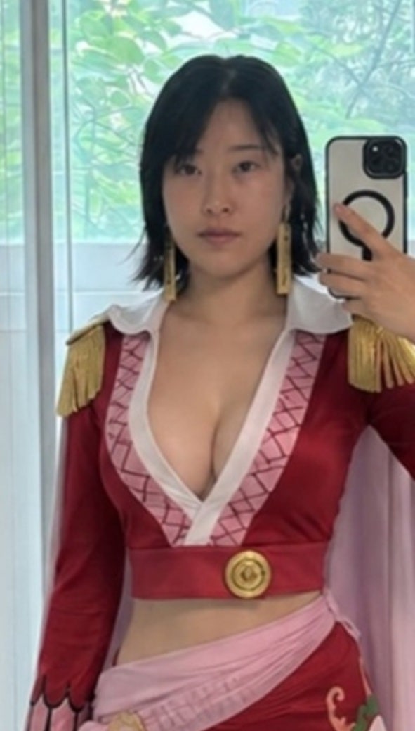 이세영 성형 부작용 이유, 달라진 몸매 비결 3가지