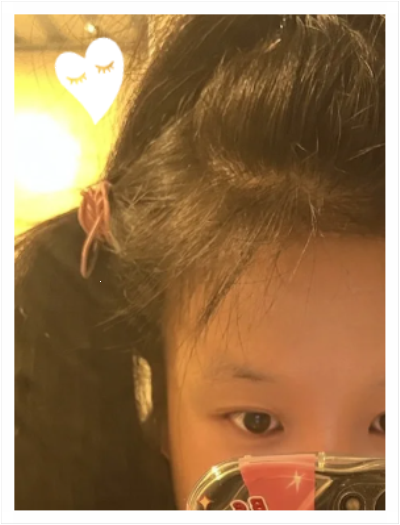 두피건선샴푸 반신반의로 써봤다가 각질 잦아든 썰