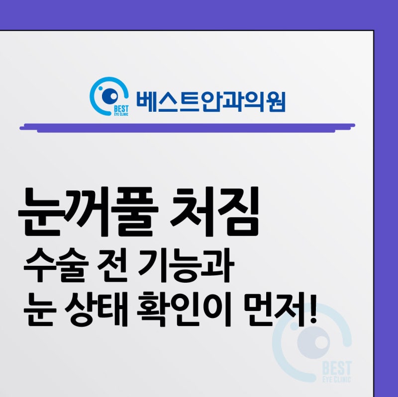 대구 성형안과, 눈꺼풀 처짐이 시야를 가린다면