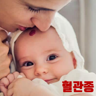 신생아 혈관종 빨간점 딸기점, 원인 치료, 헤만지올액 비용 기전