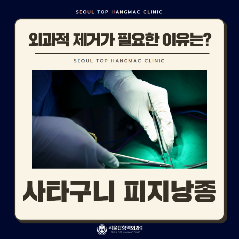사타구니 피지낭종 외과적 제거가 필요한 이유는?