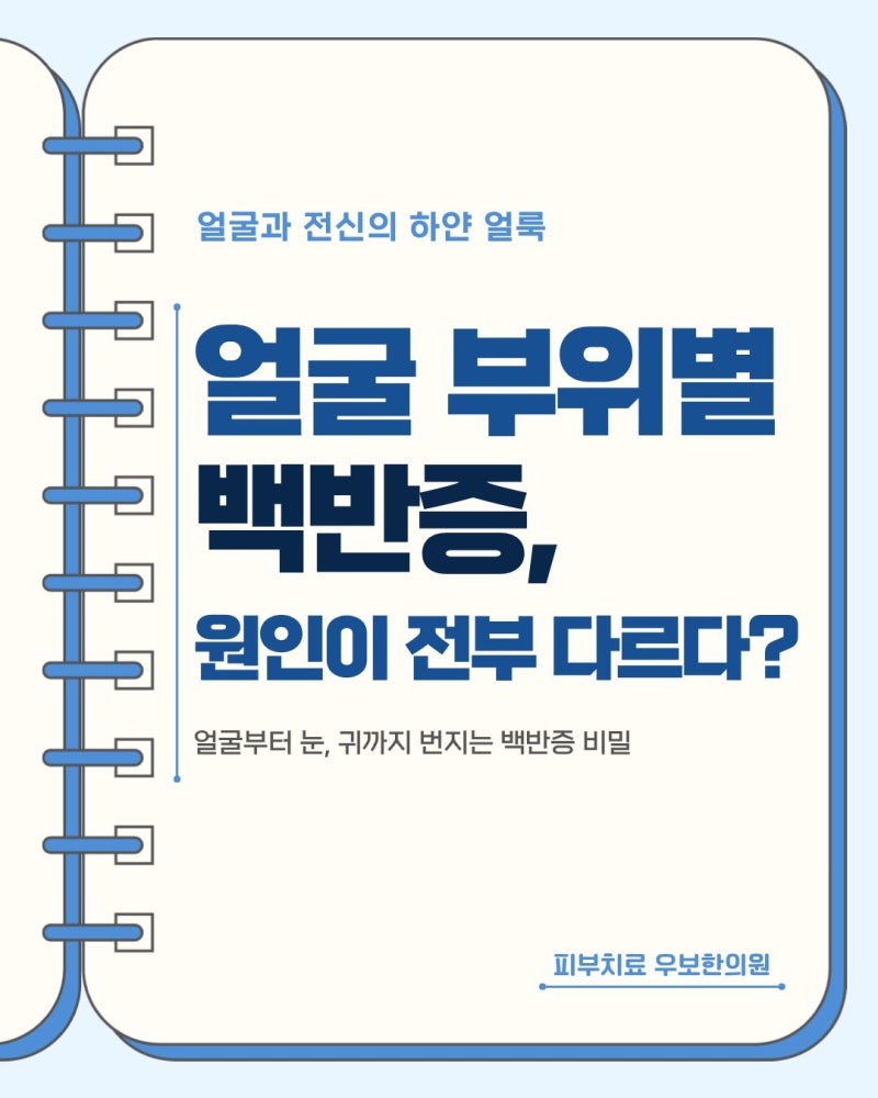 얼굴 부위별 백반증 원인이 다르다? 눈, 귀까지 번지는 하얀 반점 관리법