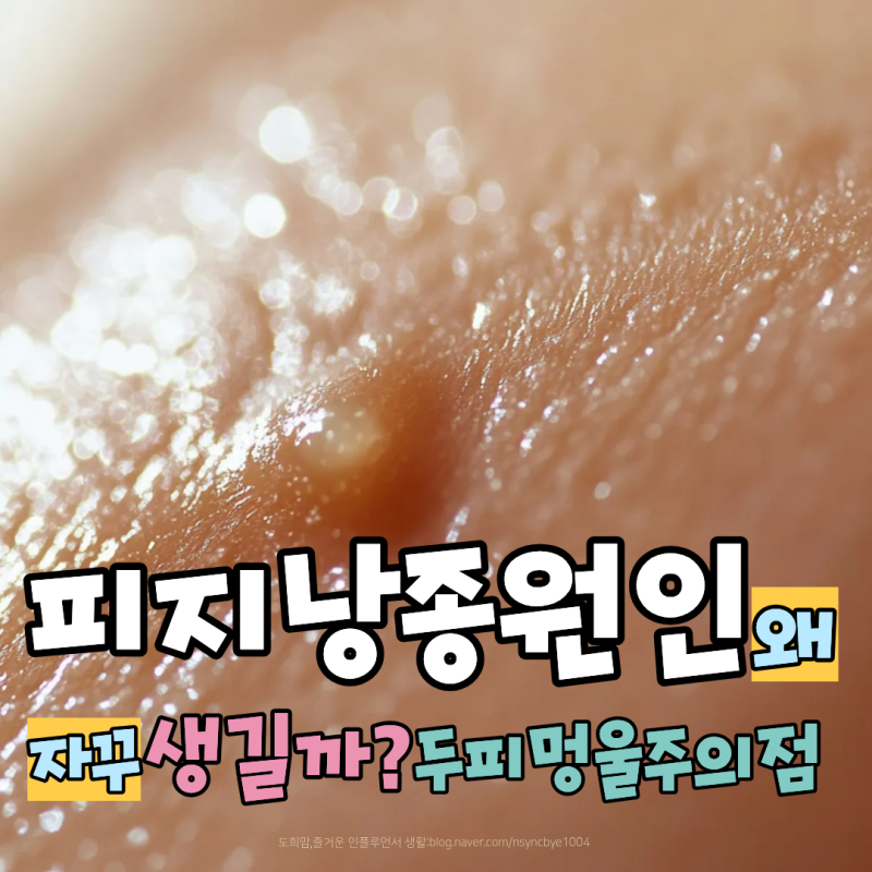 피지낭종 원인 왜 자꾸 생길까? 두피 겨드랑이 멍울 주의