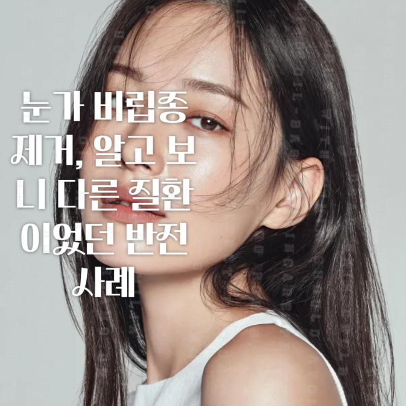 눈가 비립종 제거, 알고 보니 다른 질환이었던 반전 사례