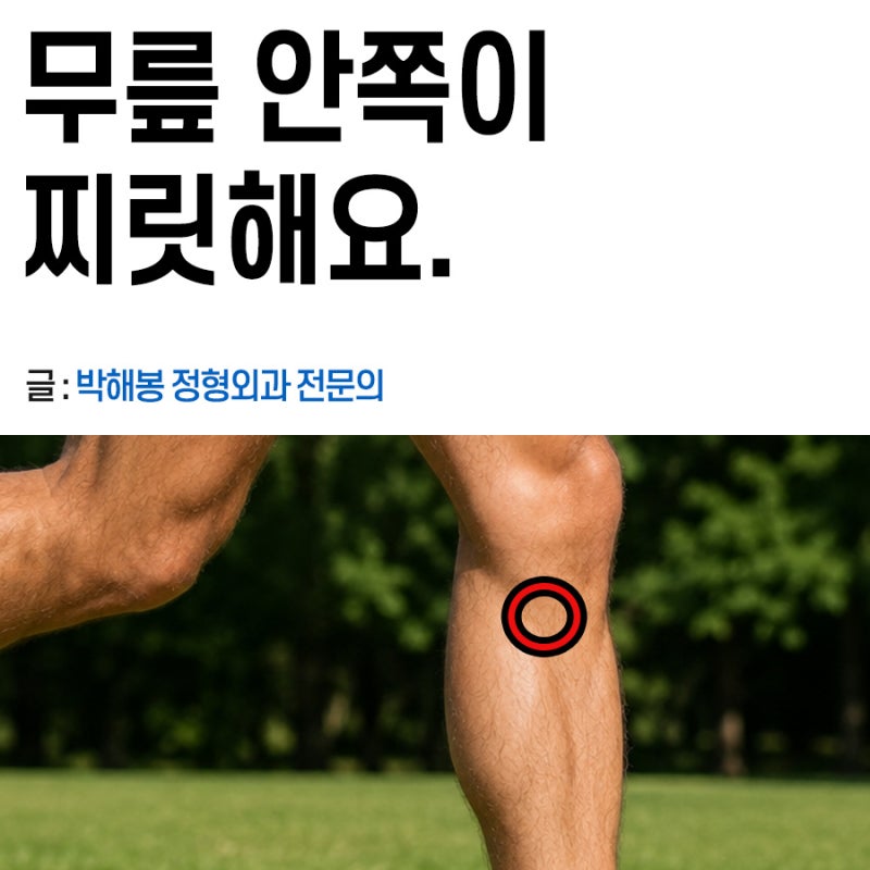 거위발건염 위치, 증상, 치료 (보호대 추천)