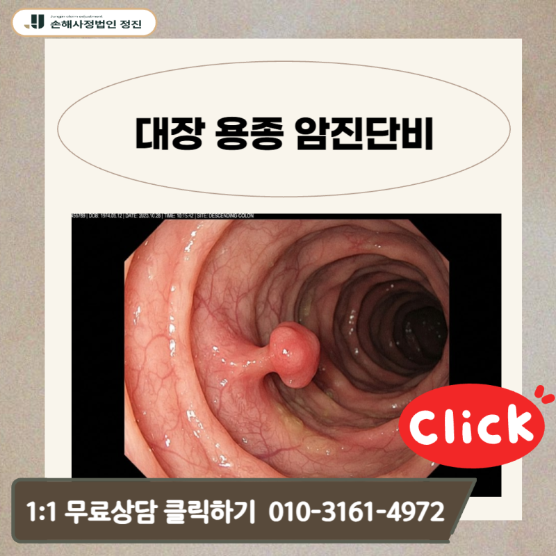 대장 용종 암진단비, D12.6 진단받고도 전액 수령하는 노하우