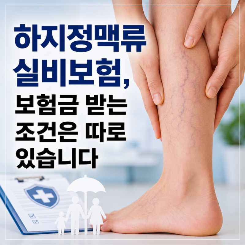 하지정맥류 실비보험 적용? 청구서류, 보험금 받는 조건은 따로 있습니다