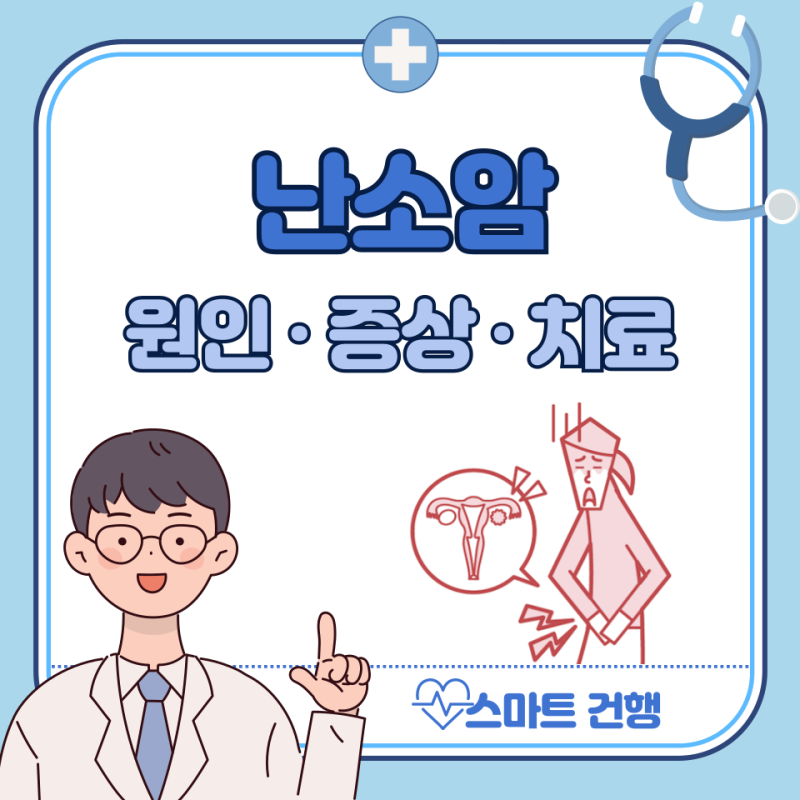 난소암 초기증상, 원인, 검사 방법 : 3기, 4기 생존율