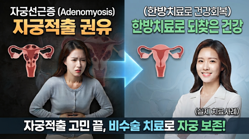 자궁선근증으로 자궁적출을 권유받았습니다. 그런데 MRI를 다시 확인한 이유가 있었습니다 (....