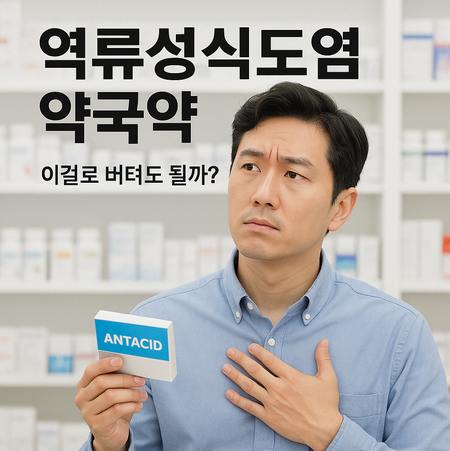 역류성식도염 약국약, 이걸로 버텨도 될까요?