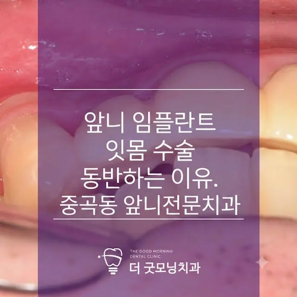 심은 사진 4