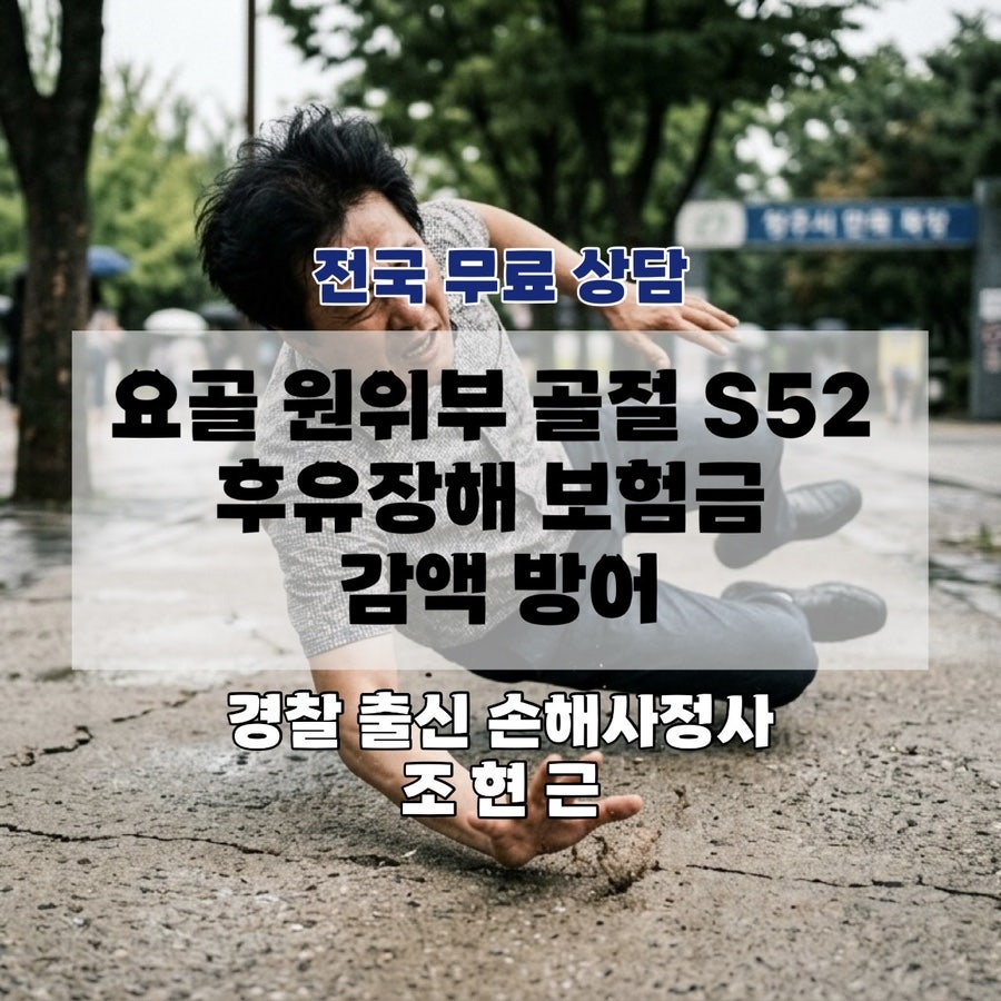 요골 사진 3