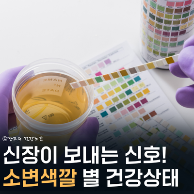 신장이 보내는 신호, 소변색깔 오줌거품 냄새 건강문제 및 대처법