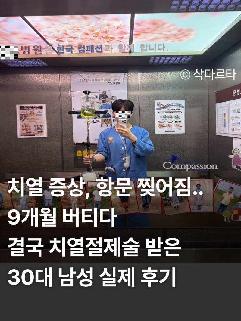 치열 증상, 항문 찢어짐.. 9개월 버티다 결국 치열절제술 받은 30대 남성 실제 후기