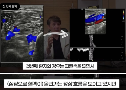 하지정맥류수술 부작용 피하려면? 상담 전 반드시 확인할 4가지