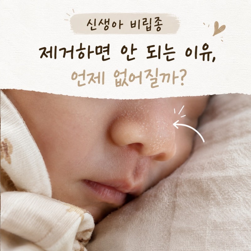 신생아 비립종 제거하면 안 되는 이유 언제 없어질까?