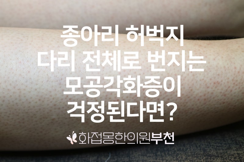 다리 전체로 번지는 종아리 허벅지 모공각화증이 고민된다면? 1인실 화접몽한의원 부천