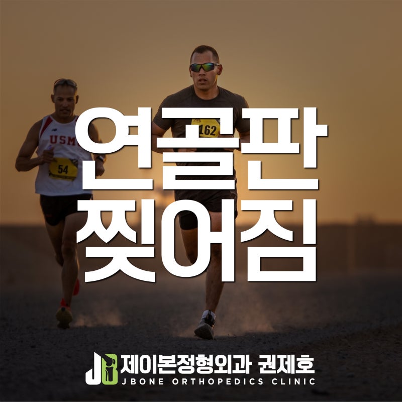 무릎 연골판 찢어짐, 30대 러너가 반월상연골판 절제술을 받은 이유
