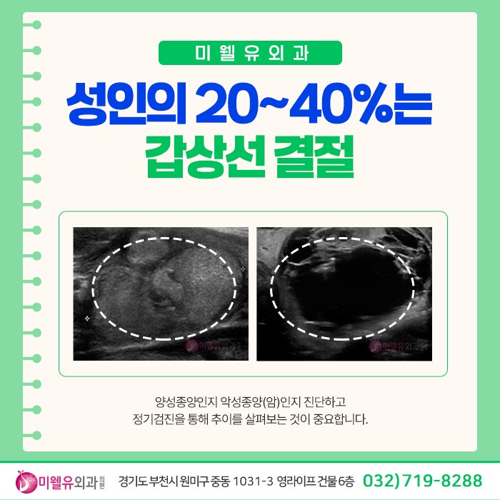 부천 외과, 오른쪽 왼쪽 목 부음 조심하세요!