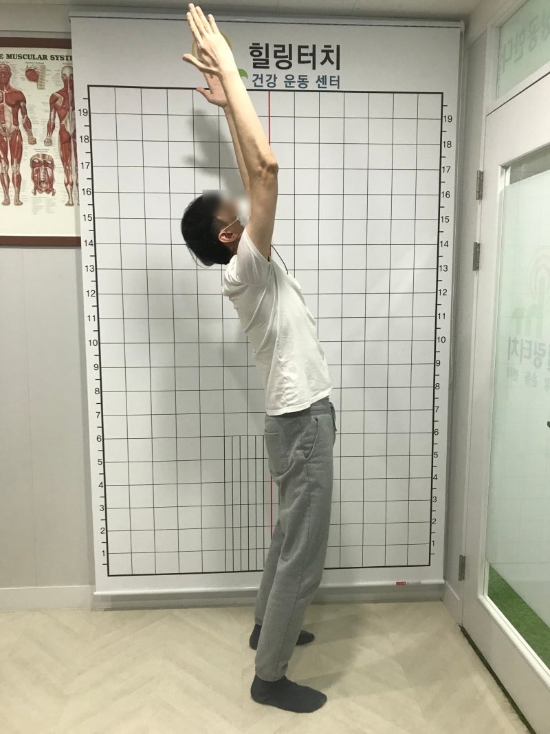 허리디스크 통증, 수술 없이 회복하는 6주 재활 솔루션