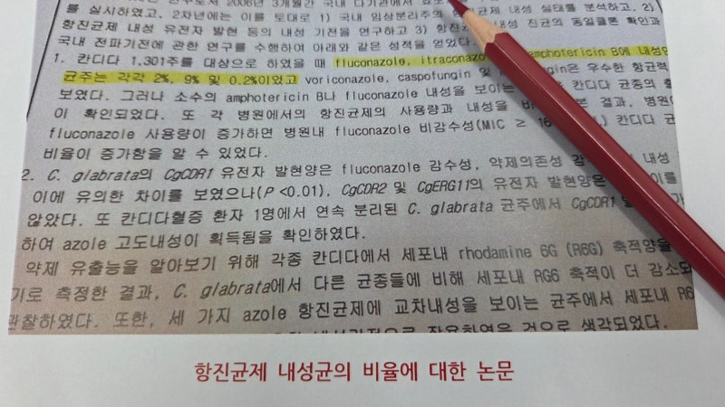 칸디다질염 약국 약 쓰는데 계속 반복하는 이유