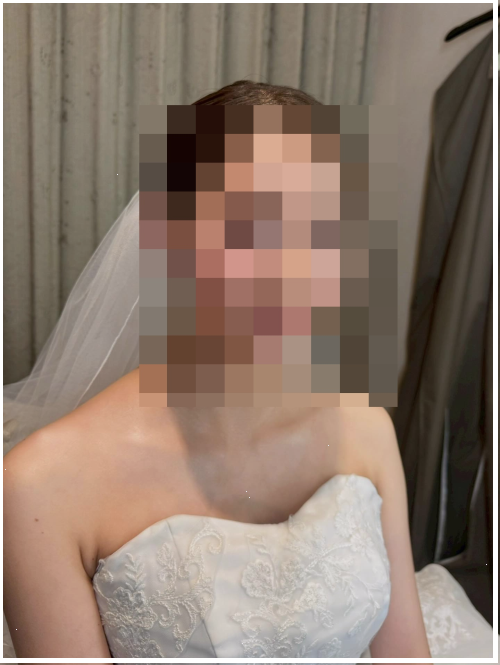 전정신경염증상 방치했다가 한 달 헤맨 썰, 이것저것 다 해본 비교후기