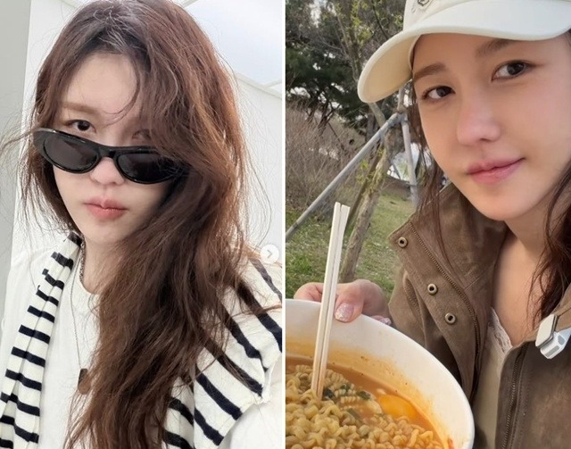 이지아, 성형설 재점화 “넣었다가 뺐다” 과거 솔직 고백 다시 주목