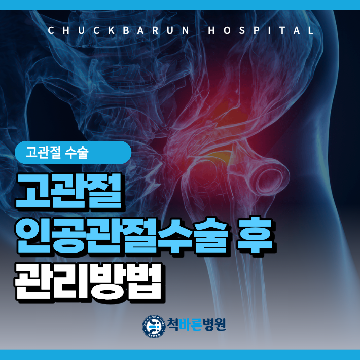고관절 인공관절수술 후 중요한 관리 방법 참고하세요 - 사당 정형외과