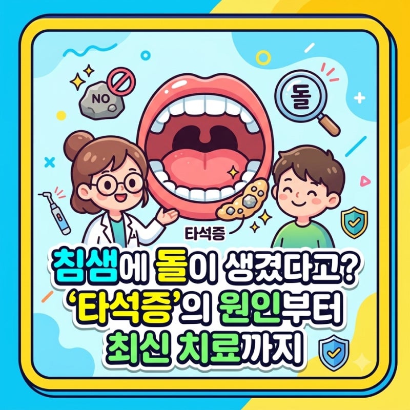 [타석증] 침샘에 돌이 생겼다고? '타석증'의 원인부터 최신 치료까지