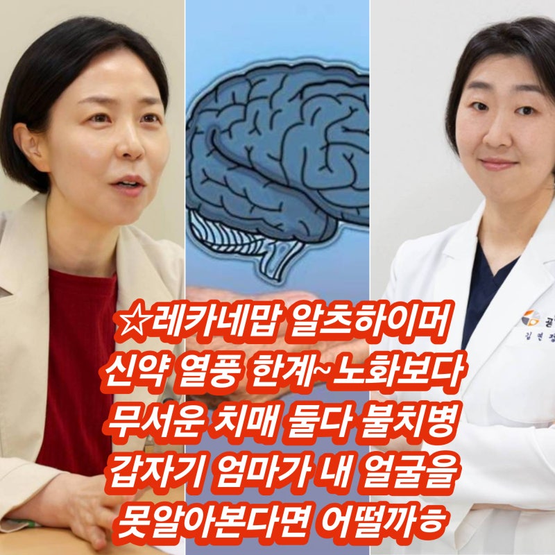 치매 노화 다른 점 "최근 일을 통째로 잊어버리는 것" 레카네맙 알츠하이머병 주사 부작용 MR....