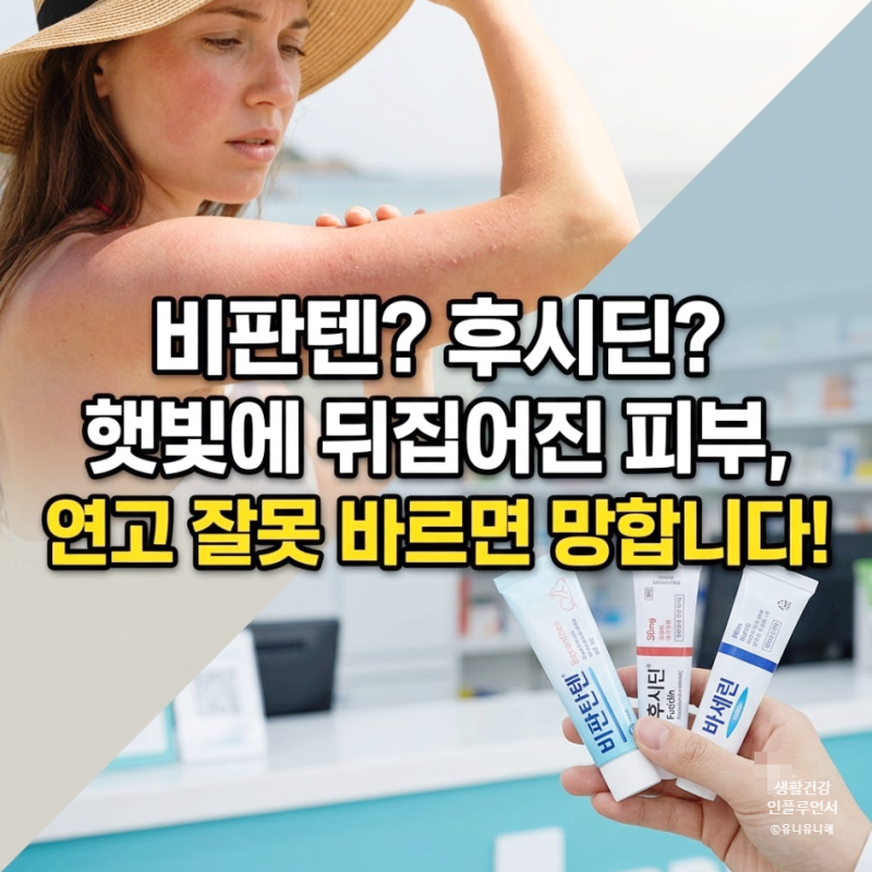 햇빛 화상과 햇빛알레르기 증상 차이! 비판텐 후시딘 바세린 연고 선택법