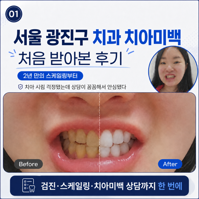 서울 광진구 치아미백 ㅣ 2년만의 치과 스케일링