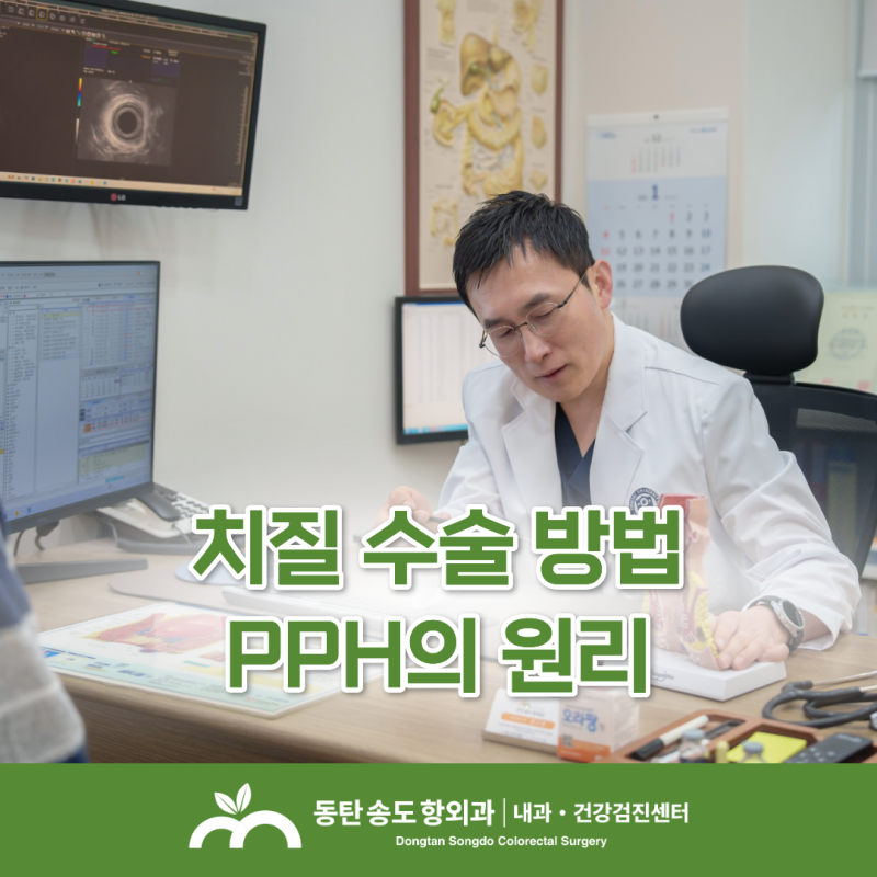 동탄항문외과 치핵 수술 PPH의 원리와 회복기간