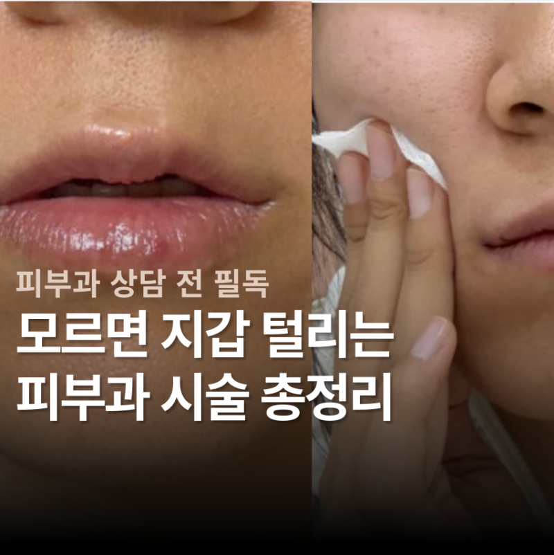 필러 콜라겐주사 차이 | 스킨부스터 스킨보톡스 물광 총정리 (쥬베룩 스컬트라)