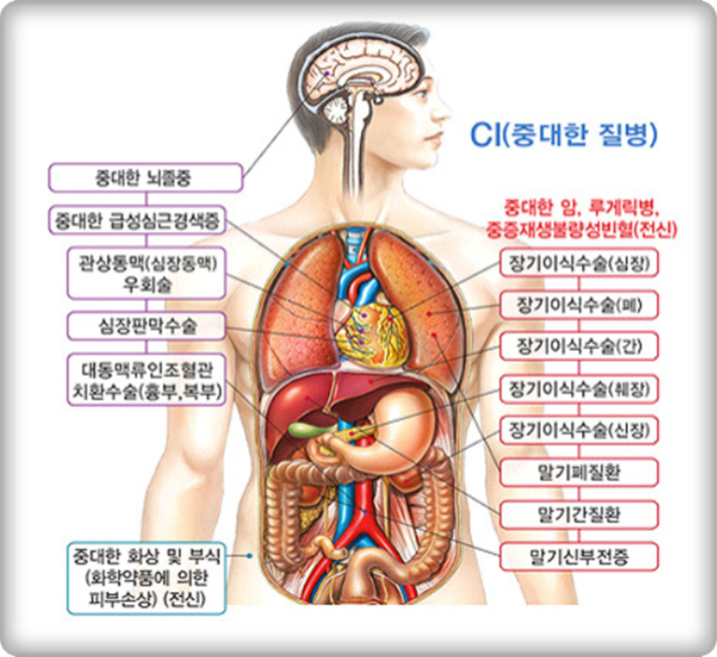 CI보험 갖고 계세요? 중대한 암, 뇌졸중, 급성심근경색증! 보험 준비하는 순서 알아보기
