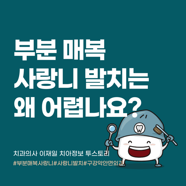 부분 매복 사랑니 발치는 왜 어렵나요? 이유 및 발치 후 관리 방법