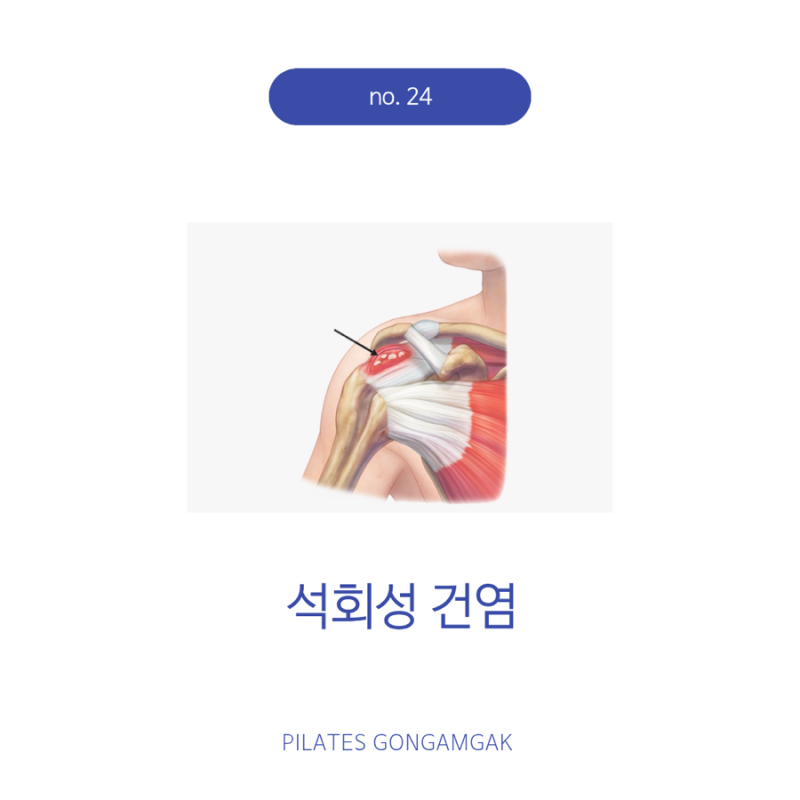 no. 24 석회성 건염