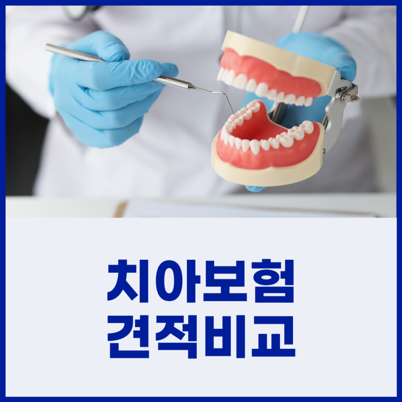 치아보험비교사이트 금액 보장내용 꼼꼼히 살펴본 가입 과정