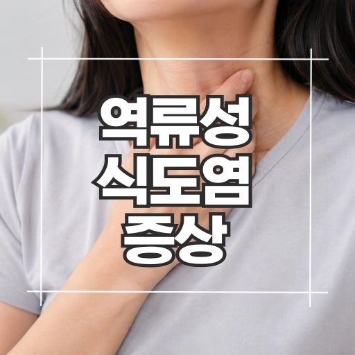 역류성식도염 증상, 목에 이물감 가슴이 타는 듯 아프다면 꼭 확인하세요