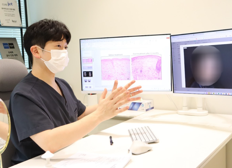 대전비립종제거, 짜도 또 올라온다면 피부과 체크포인트 세 가지