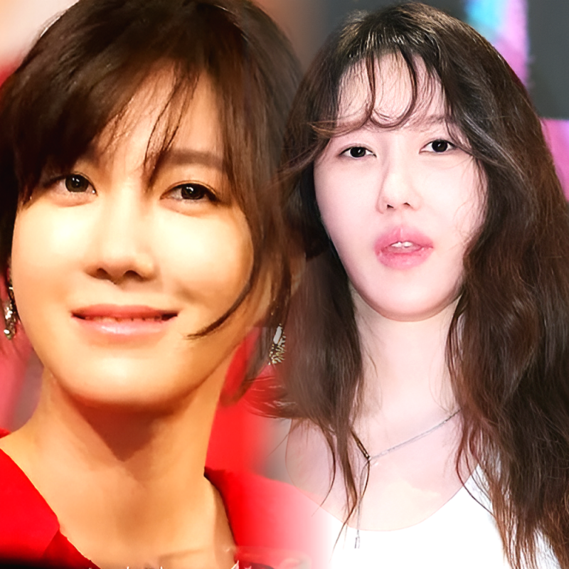 이지아 얼굴 왜? "나이 잊은 초동안 vs 낯선 분위기 성형?" 시끌시끌