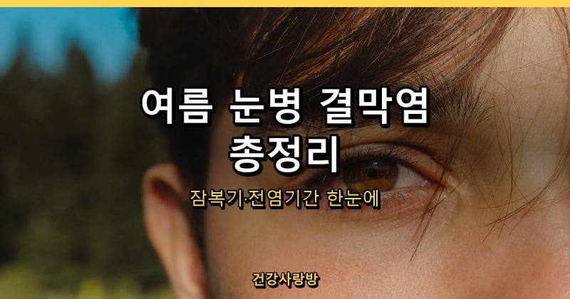 눈병(유행성 결막염) 초기증상부터 전염기간, 안약 사용법까지 총정리