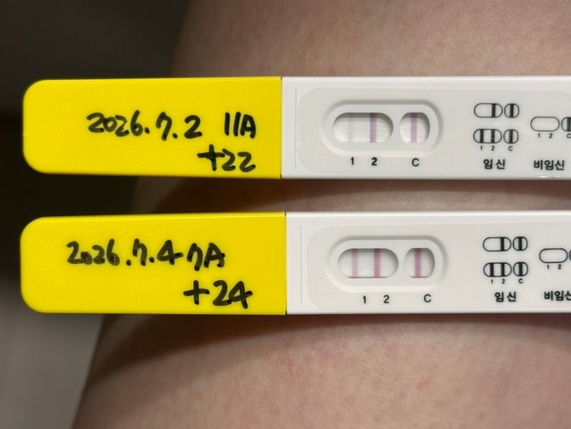 계류유산 소파술후기(동탄제일병원)수술준비 / 비용(hCG 변화)