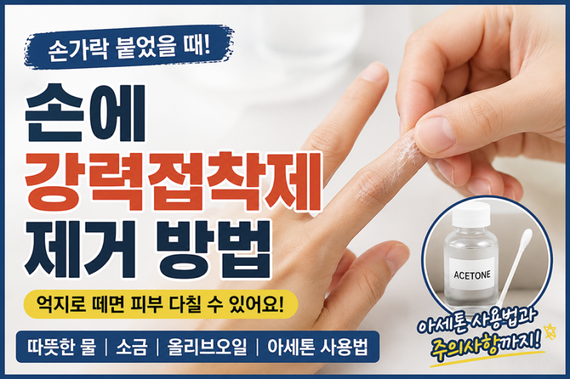 손에 강력접착제 제거 방법, 손가락 붙었을 때 억지로 떼면 안 되는 이유