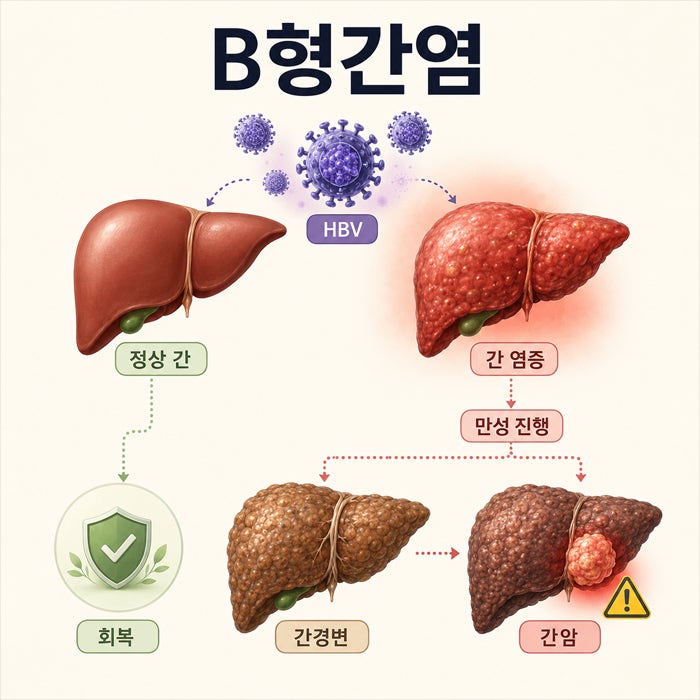 B형간염 원인과 증상, 지금 꼭 알아야 하는 이유