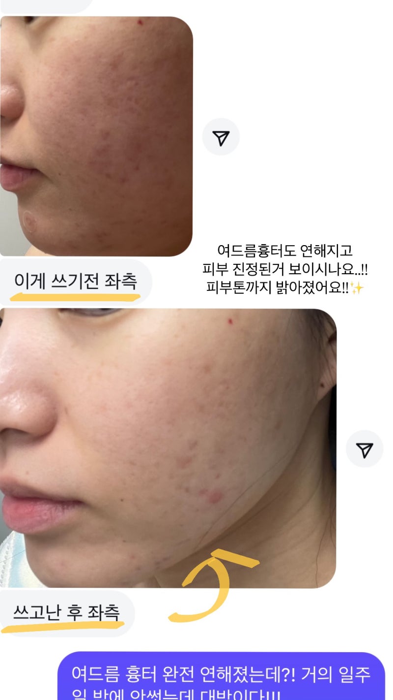 코씨 18차 공구 OPEN｜시카·콜라겐·광채·비타라인 2년 사용 후기 (+피부 변화)