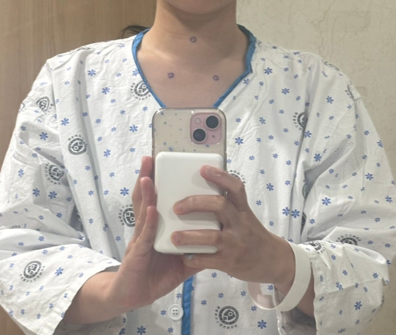 갑상선항진증(그레이브스병)으로 인한 전절제술 후기