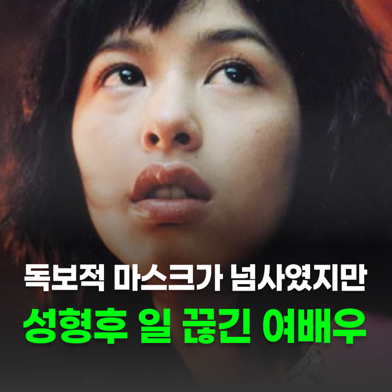 "독보적 마스크가 넘사였지만.." 성형한 후 일 전부 끊긴 여배우 리즈 시절