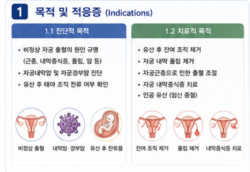 자궁소파술 자세한 설명과 전문적인 정보